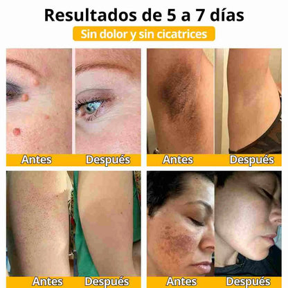 BEE VENOM DERMA