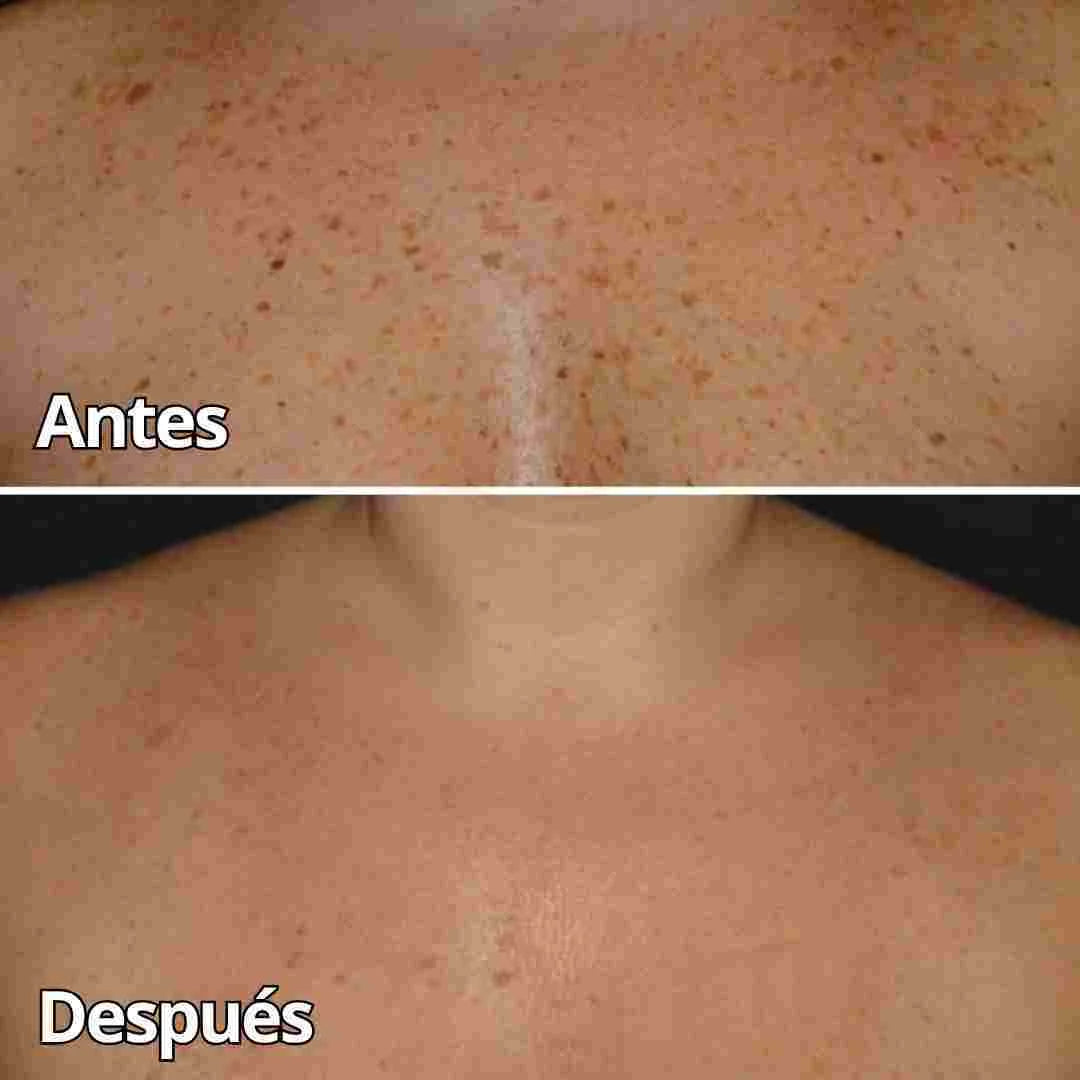 BEE VENOM DERMA